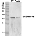 Western blot - Nucleophosmin Polyclonal Antibody from Signalway Antibody (41258) - Antibodies.com