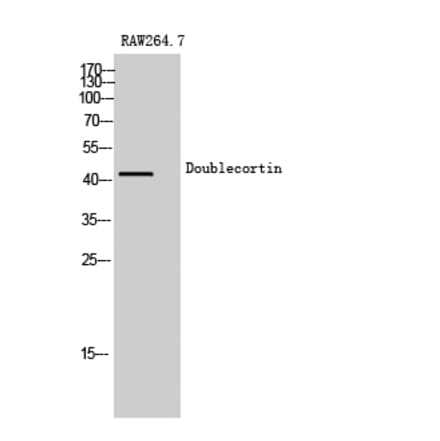 Western blot - Doublecortin Polyclonal Antibody from Signalway Antibody (40851) - Antibodies.com