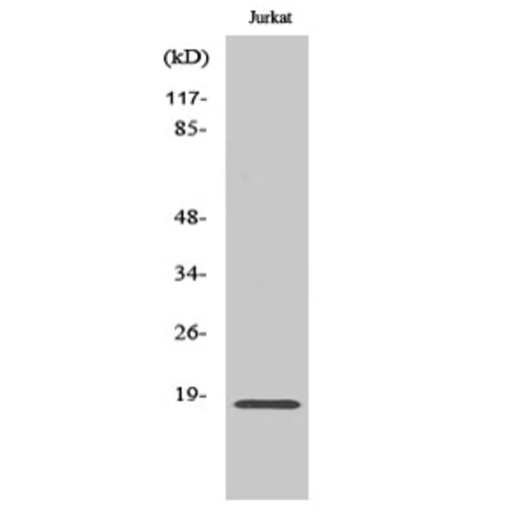 Western blot - Neuromedin-S Polyclonal Antibody from Signalway Antibody (41219) - Antibodies.com