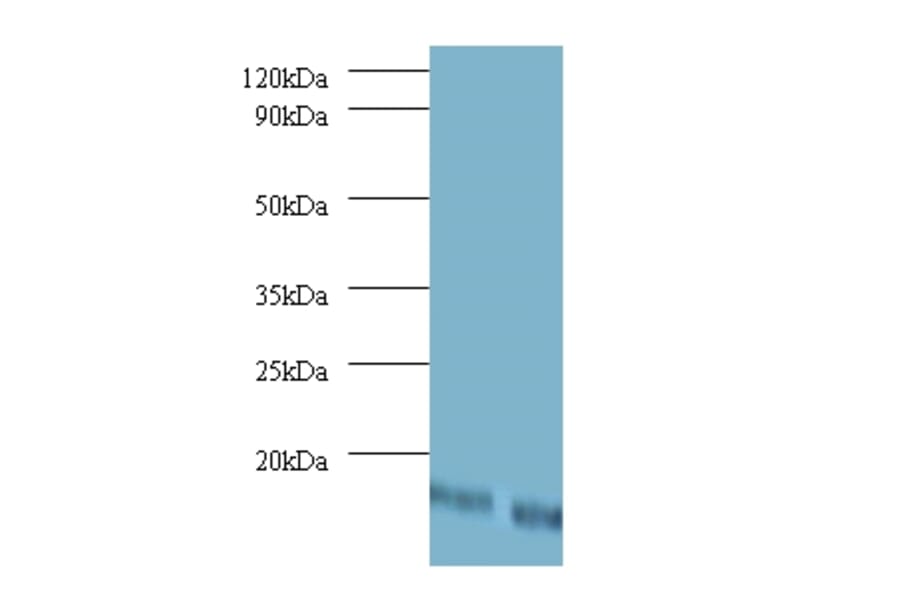 42387 from Signalway Antibody - Antibodies.com