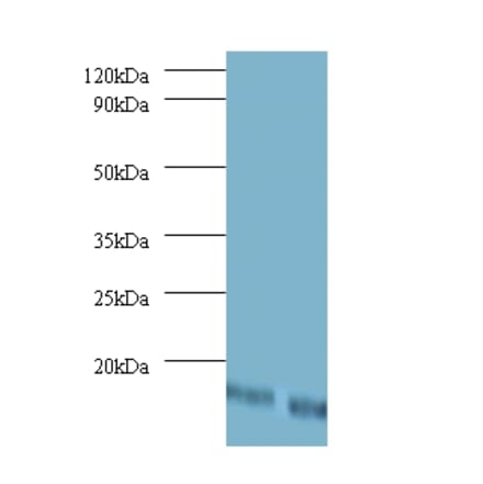 42387 from Signalway Antibody - Antibodies.com