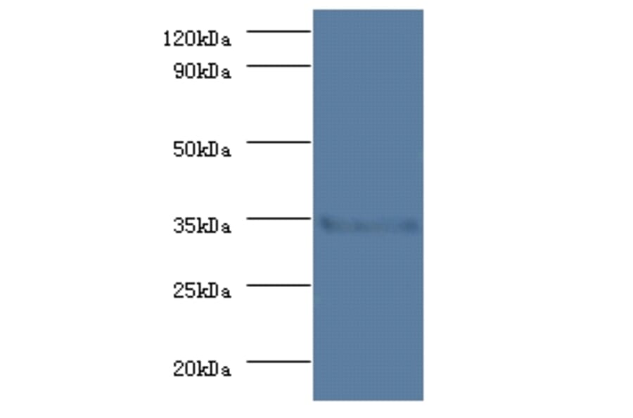 Serine/threonine-protein phosphatase 2A catalytic subunit beta isoform Polyclonal Antibody from Signalway Antibody (42191)