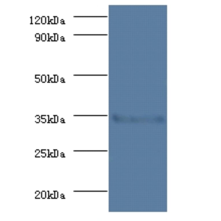 Serine/threonine-protein phosphatase 2A catalytic subunit beta isoform Polyclonal Antibody from Signalway Antibody (42191)