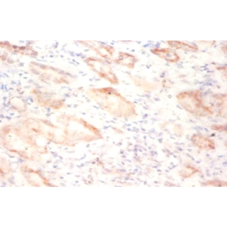 Immunohistochemistry - 42191 from Signalway Antibody - Antibodies.com