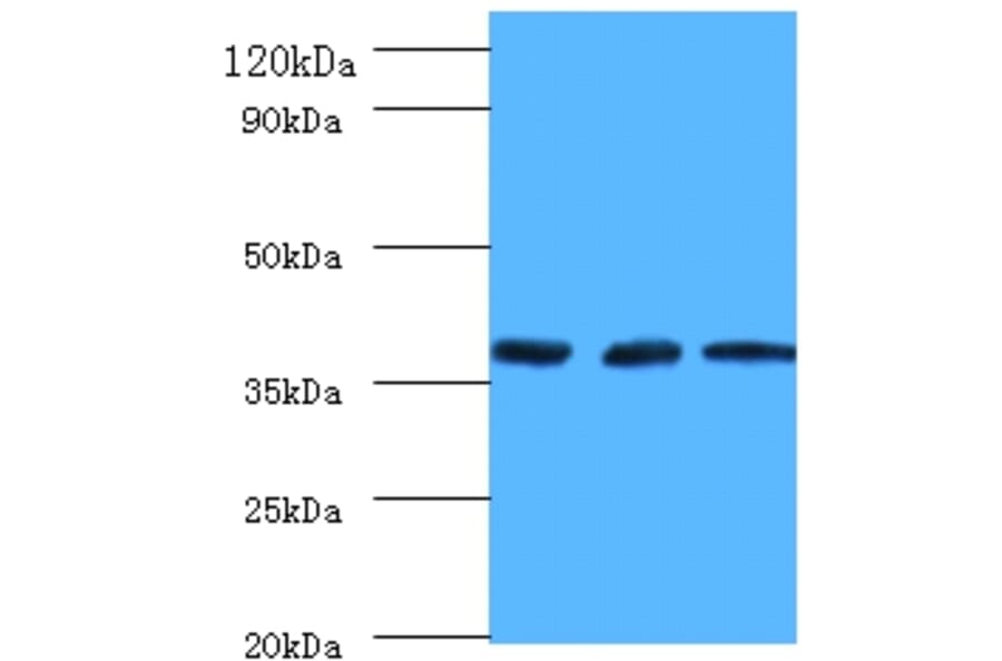 Putative tRNA (cytidine (32)/guanosine (34)-2'-O)-methyltransferase Polyclonal Antibody from Signalway Antibody (42172)