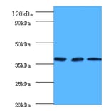 Putative tRNA (cytidine (32)/guanosine (34)-2'-O)-methyltransferase Polyclonal Antibody from Signalway Antibody (42172)