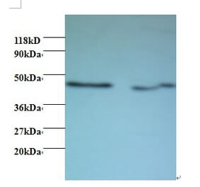 Activator of 90 kDa heat shock protein ATPase homolog 1 Polyclonal Antibody from Signalway Antibody (42435)