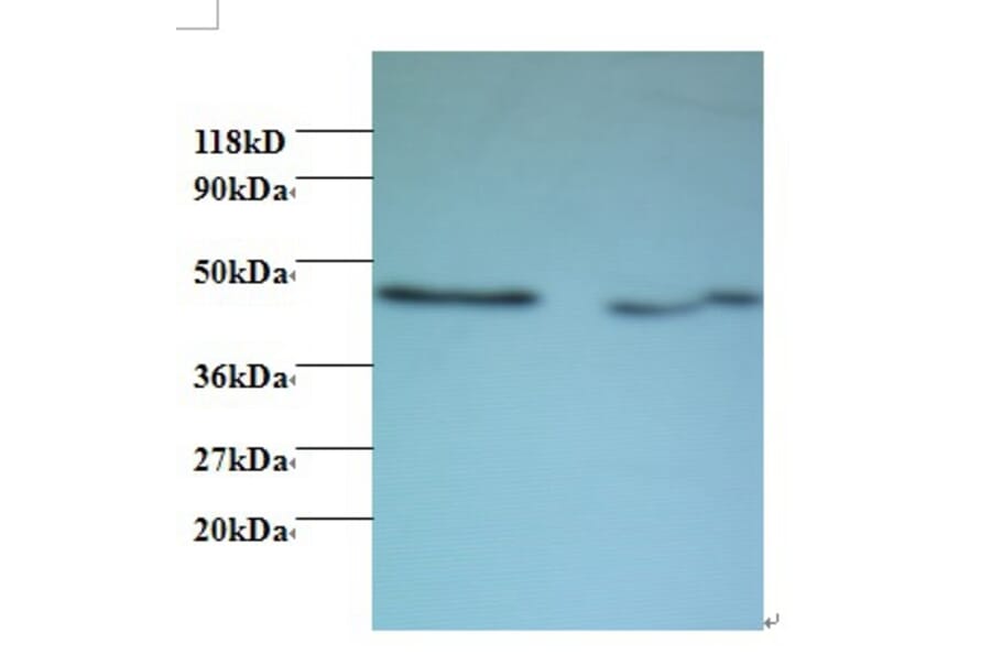 Activator of 90 kDa heat shock protein ATPase homolog 1 Polyclonal Antibody from Signalway Antibody (42435)