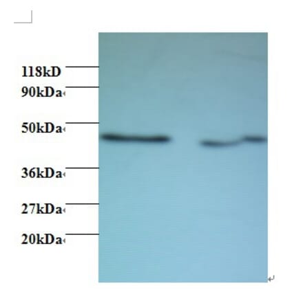 Activator of 90 kDa heat shock protein ATPase homolog 1 Polyclonal Antibody from Signalway Antibody (42435)