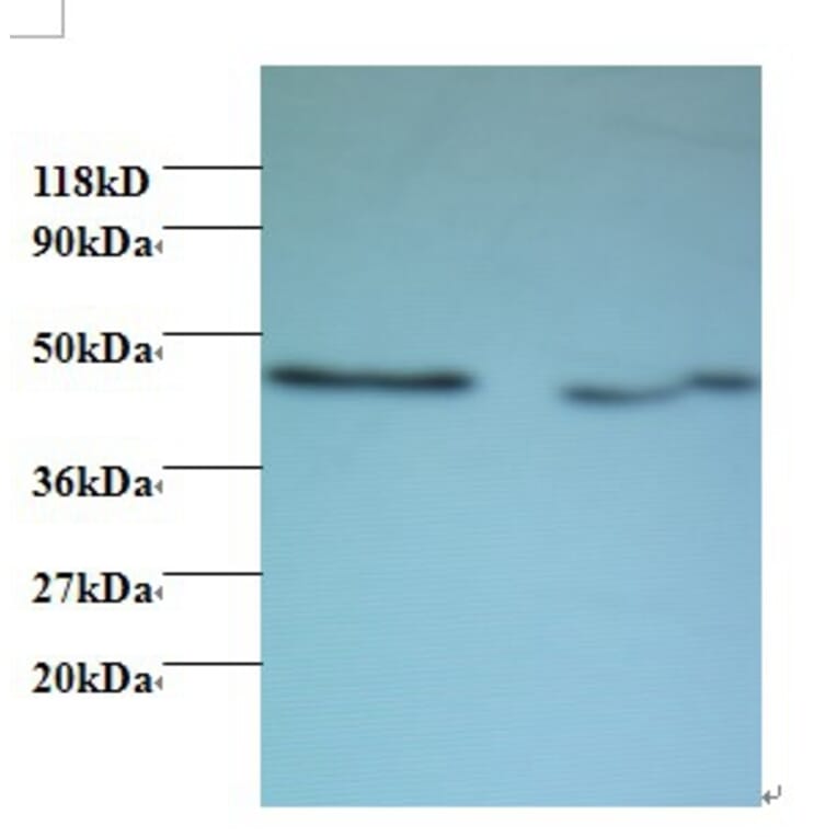 Activator of 90 kDa heat shock protein ATPase homolog 1 Polyclonal Antibody from Signalway Antibody (42435)