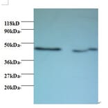 Activator of 90 kDa heat shock protein ATPase homolog 1 Polyclonal Antibody from Signalway Antibody (42435)