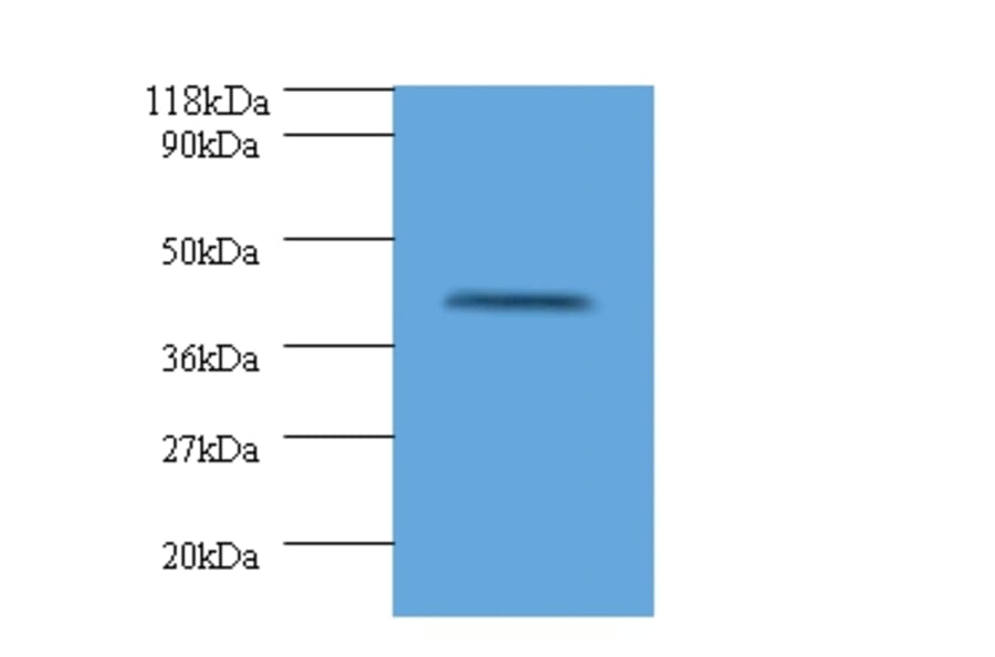HLA class I histocompatibility antigen, alpha chain G Polyclonal Antibody from Signalway Antibody (42322)