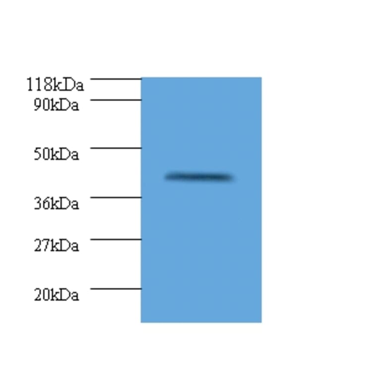 HLA class I histocompatibility antigen, alpha chain G Polyclonal Antibody from Signalway Antibody (42322)