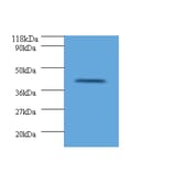 HLA class I histocompatibility antigen, alpha chain G Polyclonal Antibody from Signalway Antibody (42322)