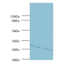 Cytochrome b-c1 complex subunit Rieske, mitochondrial Polyclonal Antibody from Signalway Antibody (42416)