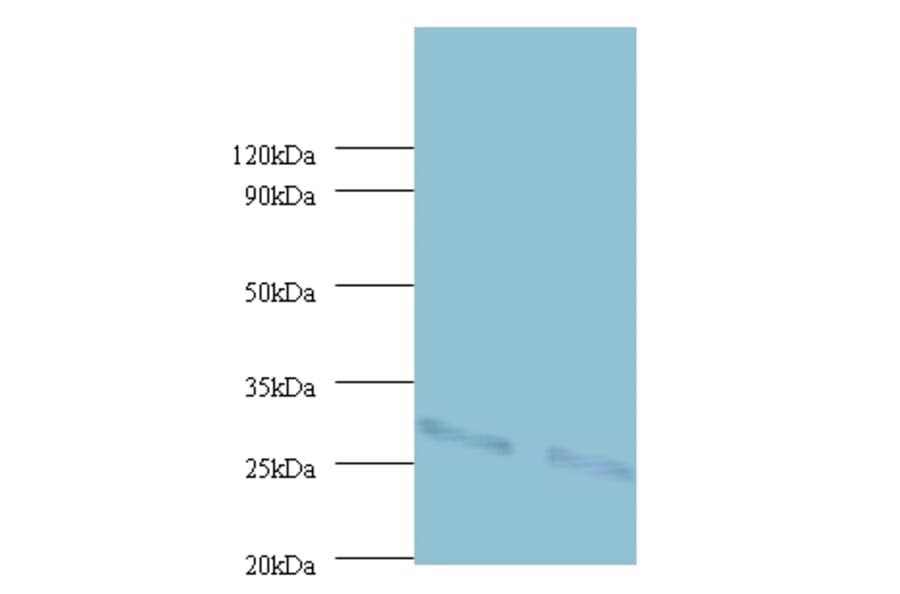 Cytochrome b-c1 complex subunit Rieske, mitochondrial Polyclonal Antibody from Signalway Antibody (42416)