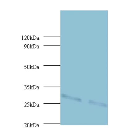 Cytochrome b-c1 complex subunit Rieske, mitochondrial Polyclonal Antibody from Signalway Antibody (42416)