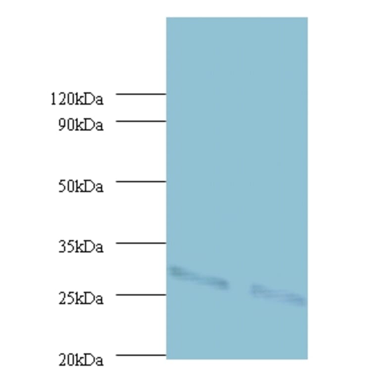 Cytochrome b-c1 complex subunit Rieske, mitochondrial Polyclonal Antibody from Signalway Antibody (42416)