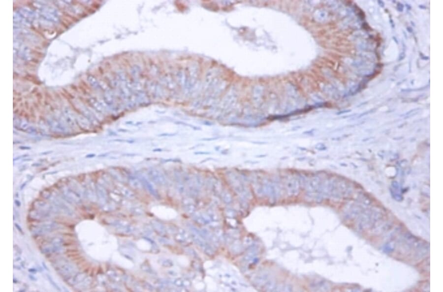 Immunohistochemistry - 42416 from Signalway Antibody - Antibodies.com