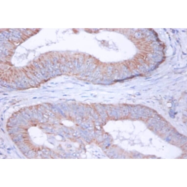 Immunohistochemistry - 42416 from Signalway Antibody - Antibodies.com