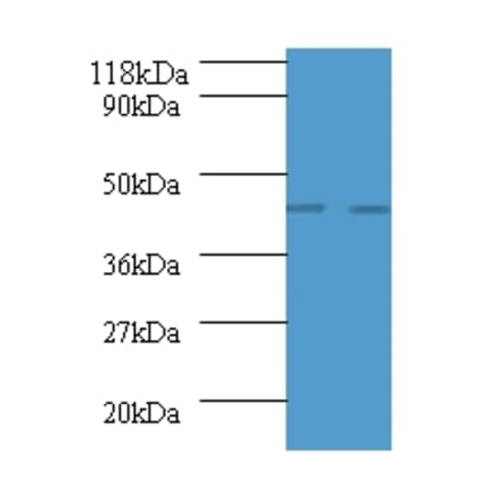 Advanced glycosylation end product-specific receptor Polyclonal Antibody from Signalway Antibody - Antibodies.com