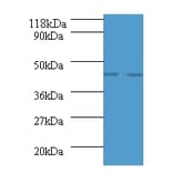 Advanced glycosylation end product-specific receptor Polyclonal Antibody from Signalway Antibody - Antibodies.com