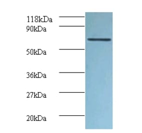 Tumor necrosis factor receptor superfamily member 6 Polyclonal Antibody from Signalway Antibody - Antibodies.com