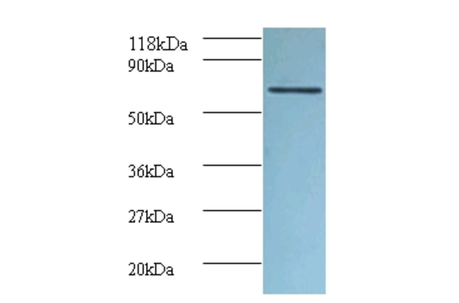 Tumor necrosis factor receptor superfamily member 6 Polyclonal Antibody from Signalway Antibody - Antibodies.com