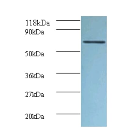 Tumor necrosis factor receptor superfamily member 6 Polyclonal Antibody from Signalway Antibody - Antibodies.com