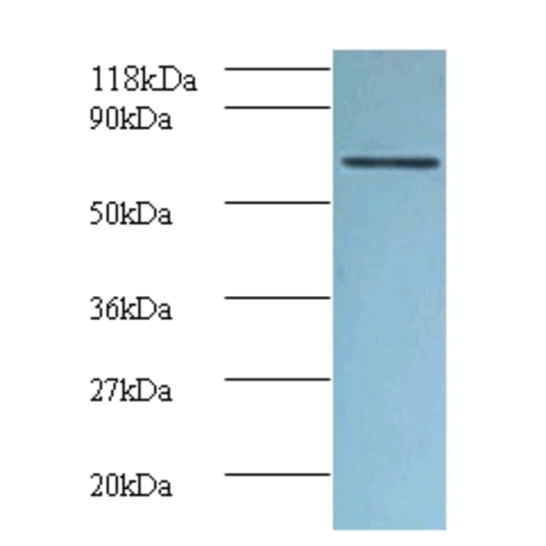 Tumor necrosis factor receptor superfamily member 6 Polyclonal Antibody from Signalway Antibody - Antibodies.com