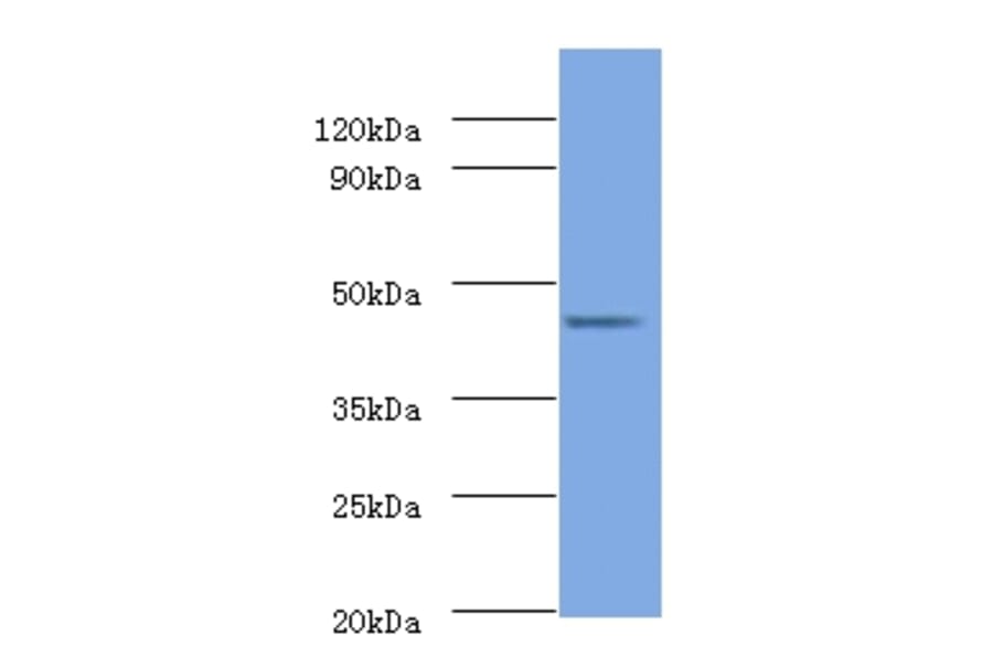 26S proteasome non-ATPase regulatory subunit 11 Polyclonal Antibody from Signalway Antibody (42132) - Antibodies.com