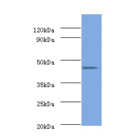 26S proteasome non-ATPase regulatory subunit 11 Polyclonal Antibody from Signalway Antibody (42132) - Antibodies.com