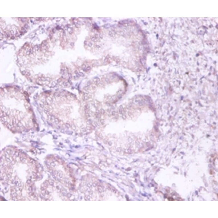 Immunohistochemistry - 26S proteasome non-ATPase regulatory subunit 11 Polyclonal Antibody from Signalway Antibody (42132)