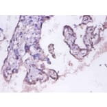 Immunohistochemistry - 26S proteasome non-ATPase regulatory subunit 11 Polyclonal Antibody from Signalway Antibody (42132)