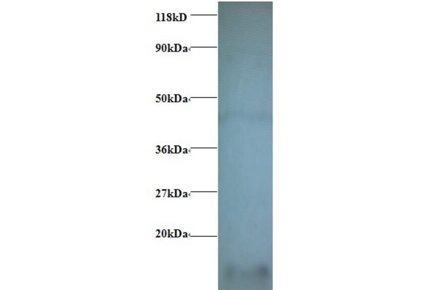 Cytochrome c oxidase subunit 6A1, mitochondrial Polyclonal Antibody from Signalway Antibody (42340) - Antibodies.com