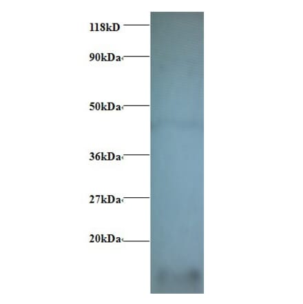 Cytochrome c oxidase subunit 6A1, mitochondrial Polyclonal Antibody from Signalway Antibody (42340) - Antibodies.com