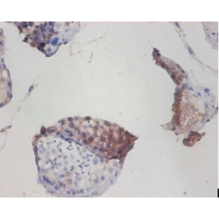 Immunohistochemistry - Cytochrome c oxidase subunit 6A1, mitochondrial Polyclonal Antibody from Signalway Antibody (42340)