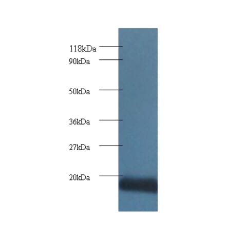 Cytochrome c oxidase subunit 5A, mitochondrial Polyclonal Antibody from Signalway Antibody (42096) - Antibodies.com