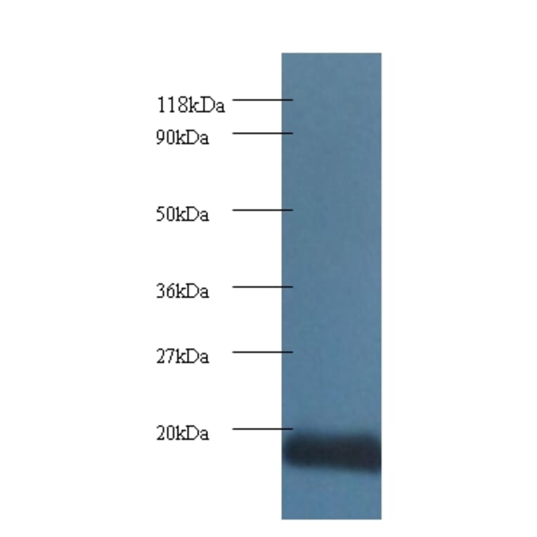 Cytochrome c oxidase subunit 5A, mitochondrial Polyclonal Antibody from Signalway Antibody (42096) - Antibodies.com