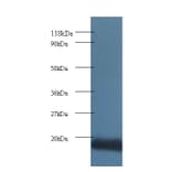 Cytochrome c oxidase subunit 5A, mitochondrial Polyclonal Antibody from Signalway Antibody (42096) - Antibodies.com