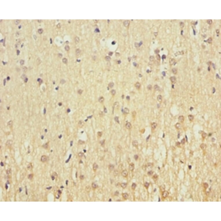 Immunohistochemistry - Cytochrome c oxidase subunit 5A, mitochondrial Polyclonal Antibody from Signalway Antibody (42096)