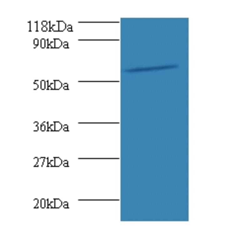 O-phosphoseryl-tRNA (Sec) selenium transferase Polyclonal Antibody from Signalway Antibody (42582) - Antibodies.com