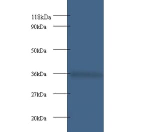 Cytochrome c1, heme protein, mitochondrial Polyclonal Antibody from Signalway Antibody (42261) - Antibodies.com
