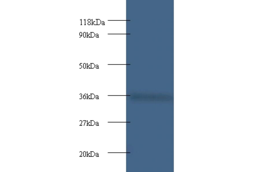 Cytochrome c1, heme protein, mitochondrial Polyclonal Antibody from Signalway Antibody (42261) - Antibodies.com