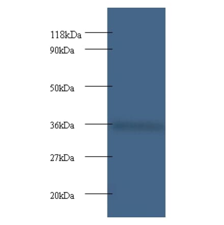 Cytochrome c1, heme protein, mitochondrial Polyclonal Antibody from Signalway Antibody (42261) - Antibodies.com