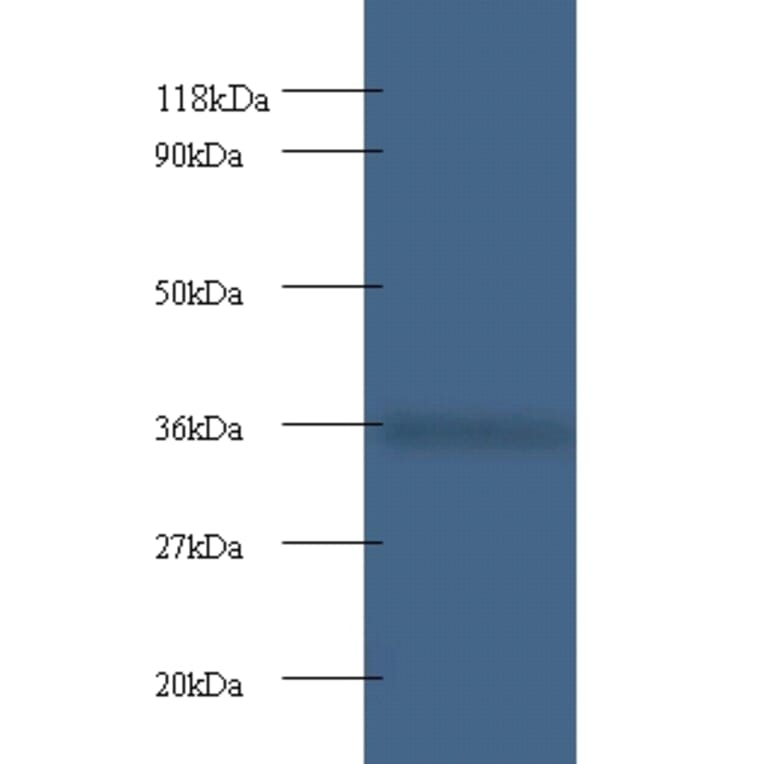 Cytochrome c1, heme protein, mitochondrial Polyclonal Antibody from Signalway Antibody (42261) - Antibodies.com