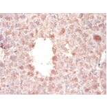 Immunohistochemistry - X-ray repair cross-complementing protein 6 Polyclonal Antibody from Signalway Antibody (42275)