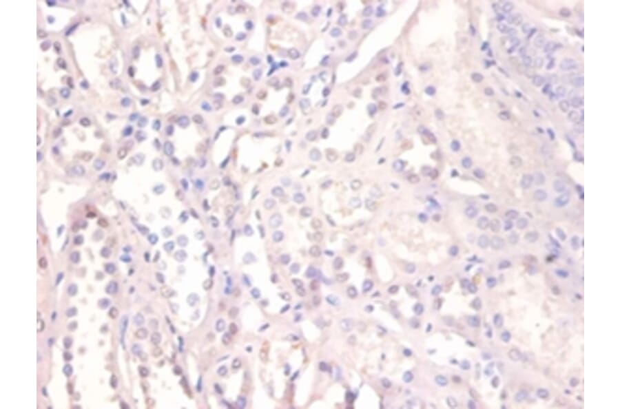 Immunohistochemistry - X-ray repair cross-complementing protein 6 Polyclonal Antibody from Signalway Antibody (42275)