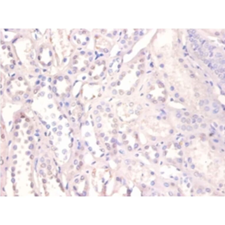 Immunohistochemistry - X-ray repair cross-complementing protein 6 Polyclonal Antibody from Signalway Antibody (42275)