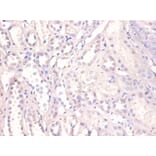 Immunohistochemistry - X-ray repair cross-complementing protein 6 Polyclonal Antibody from Signalway Antibody (42275)